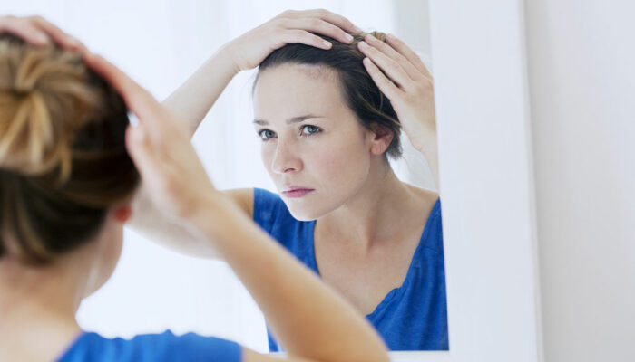 Hair loss and natural care tips to manage it