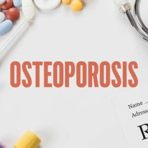 Ten steps to avoid or reverse osteoporosis